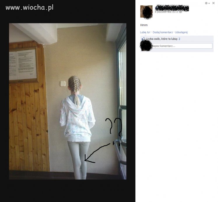 Czy jej się kolano przesunęło? 