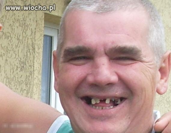 Bezzębna piękność