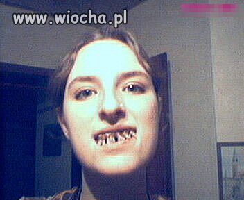 Kto chce buzi?