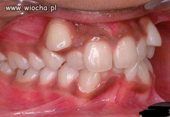 Dentyści mają