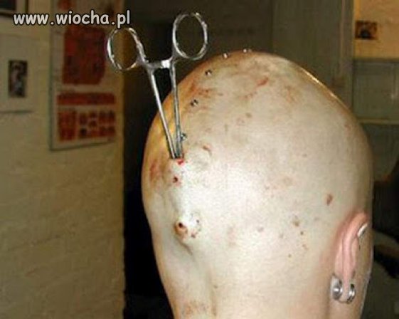 Antena