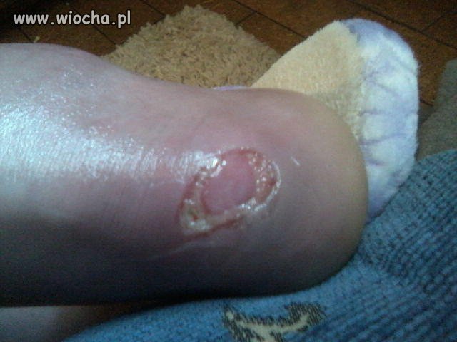 Wiocha na nk