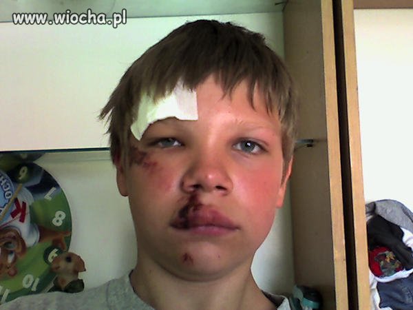 Młody lasnuje, że sie bił