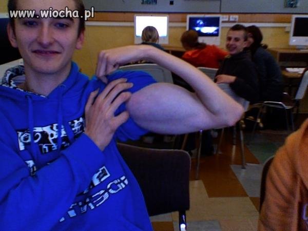 Biceps
