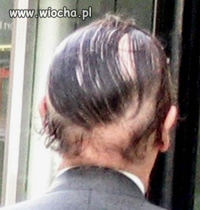 Maskowanie łysiny
