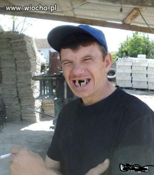 Tak jest jak sie nie myje zebow
