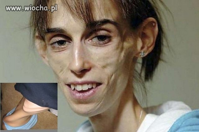 Myśli, że jest piękna, bo chuda!