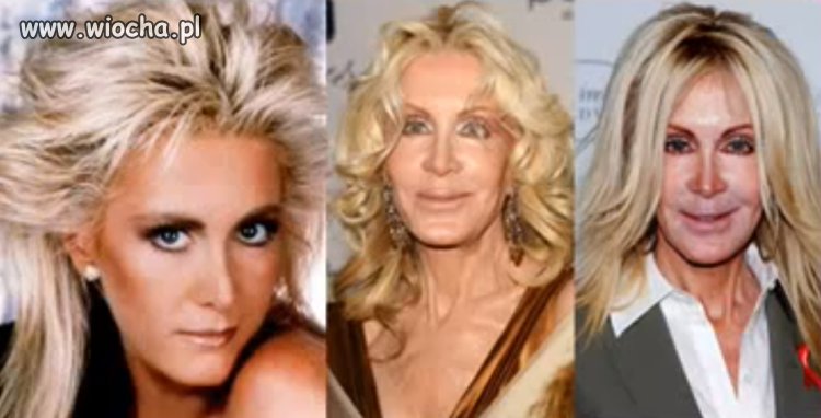 Joan Van Ark