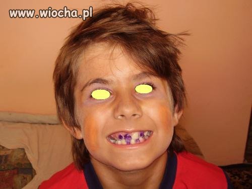 Przydałaby się wizyta u dentysty.