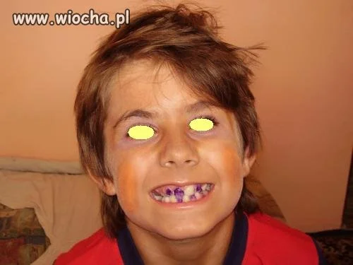 Przydałaby się wizyta u dentysty.