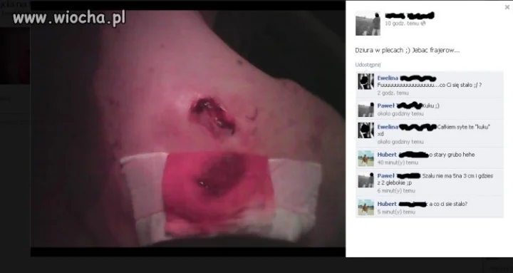 Lans na dziurę w plecach