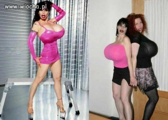 Jak botox z botoxem