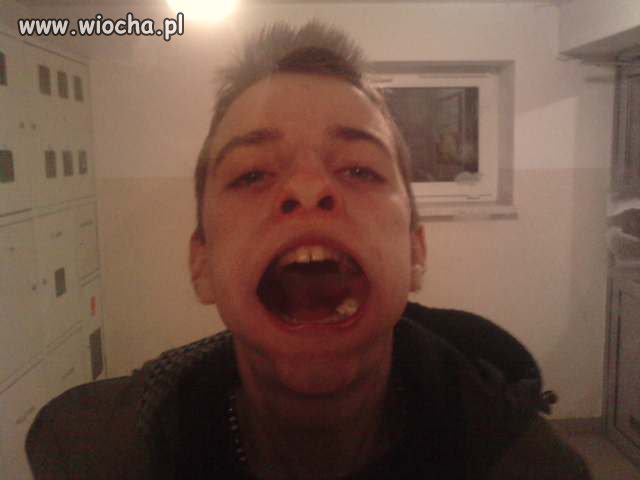 Nie ma to jak chwalić się krzywymi zębami