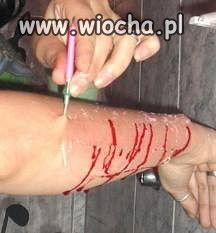 Jak można sobie coś takiego zrobić???