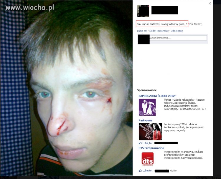 Pogryziony przez własnego psa.