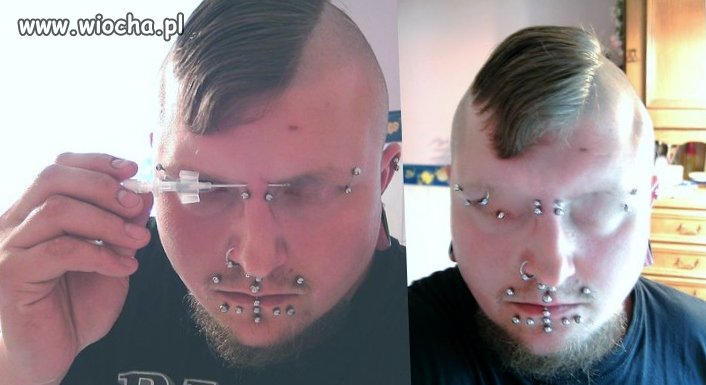 Podziwiam odporność na ból