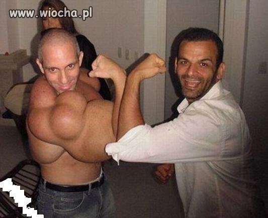 Przerost masy 