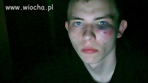 Takie tam po biciu...