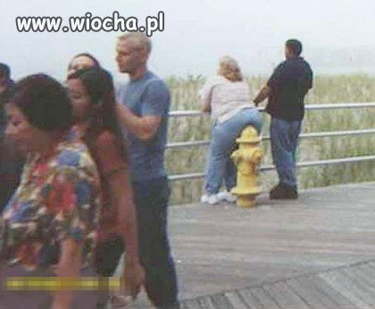 Bolą cię nogi?