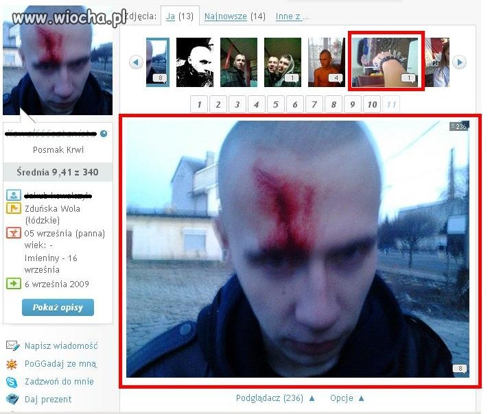 Rozcięte czoło