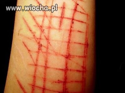Pociąć się i pochwalić się tym na nk