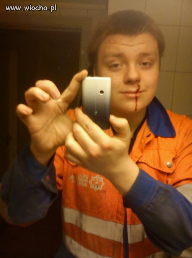 Skaleczenie