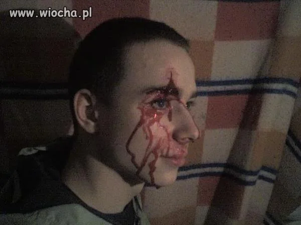 Trzeba się pochwalić zbitym ryjem.