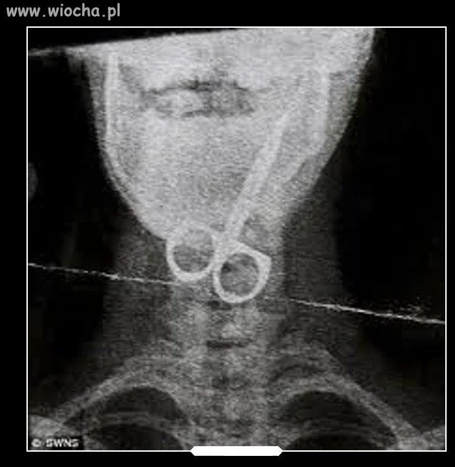 Hardcore