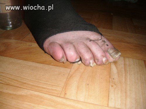 Fuuu..