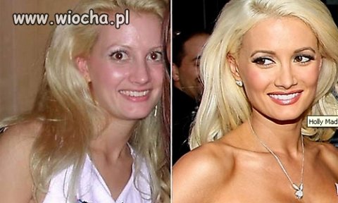 Masz sztuczne piersi, usta, tlenione włosy?
