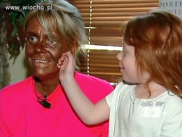 Matka, która poparzyła dziecko na solarium