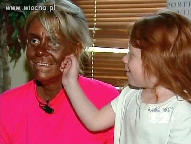 Matka, która poparzyła dziecko na solarium