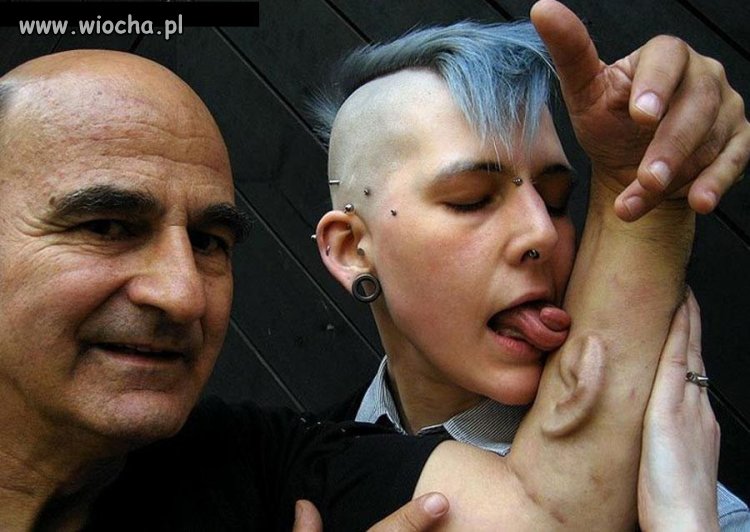 Implant ucha w ręce?