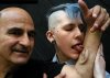Implant ucha w ręce?