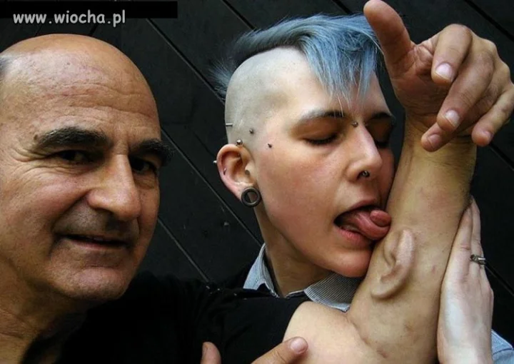 Implant ucha w ręce?