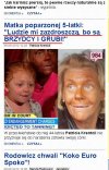 Poparzyła własne dziecko na solarium