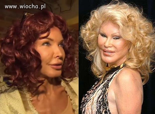Chciała być piękniejsza,  a wyszło ohydnie. 