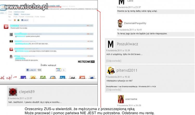 Odebrano rente pacjentowi po przeszczepie ręki.