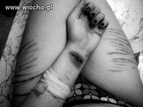 Siędzę w majtkach i się tnę..