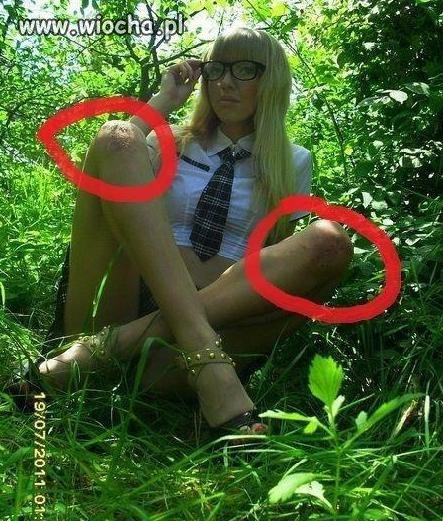 Zdarte kolana.