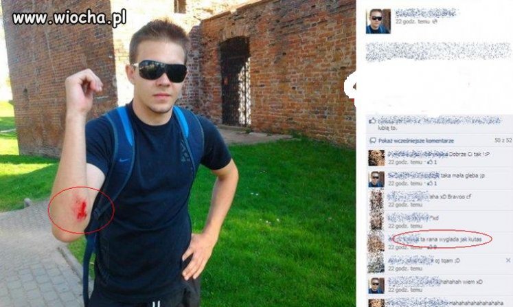 Ta rana wygląda jak kut...