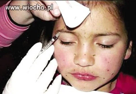 8-letnia dziewczynka...