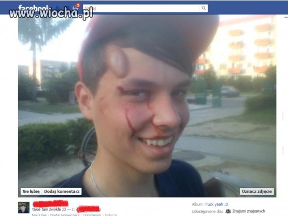 Wywrócił się. Ok...  każdemu się może zdarzyć