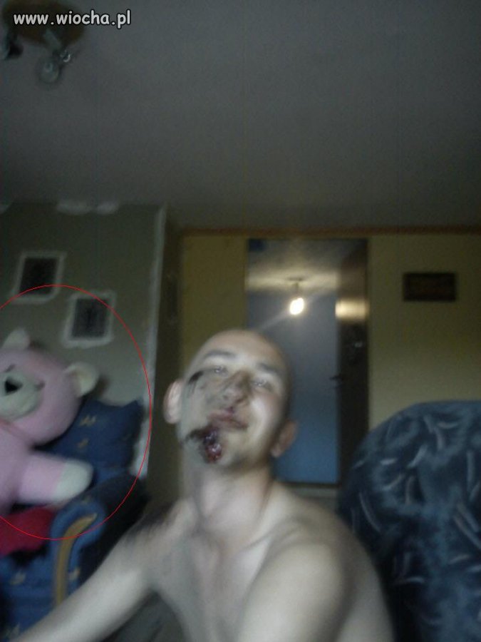Koleś z rozwalonym ryjem ... i ten różowy miś
