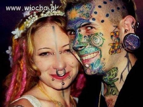 Lekkie kalectwo twarzy.