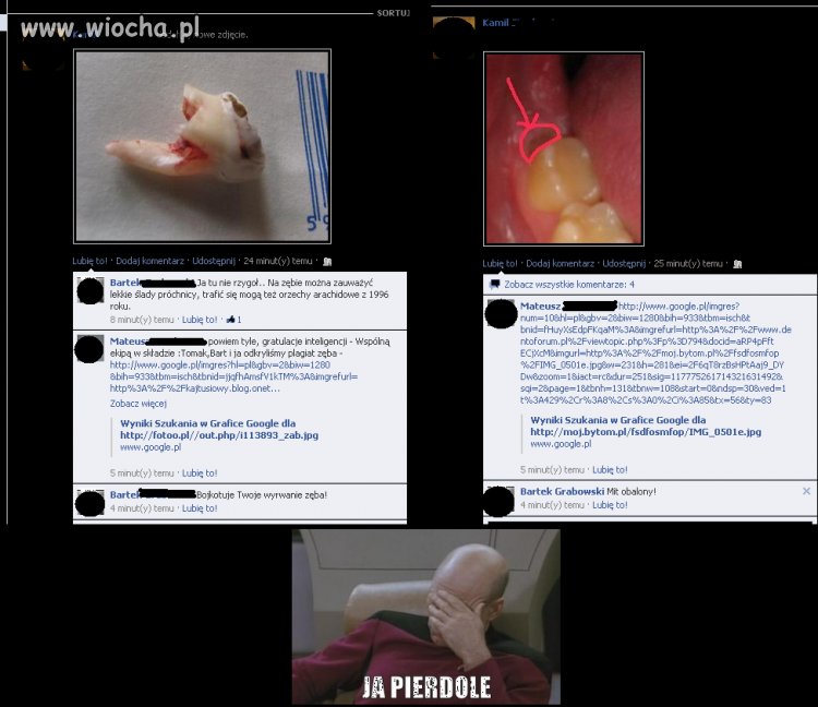 Nie ma to jak się pochwalić wyrwanym zębem.