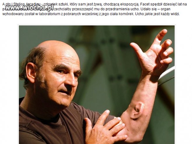 Artysta i jego nadprogramowy organ.