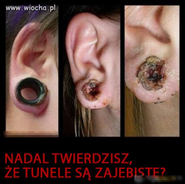 Nie daj się oszpecić!