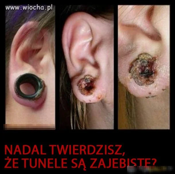 Nie daj się oszpecić!