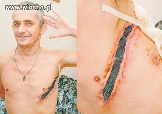 Człowiek z zamkiem błyskawicznym